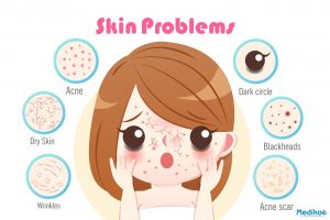skin problem banner